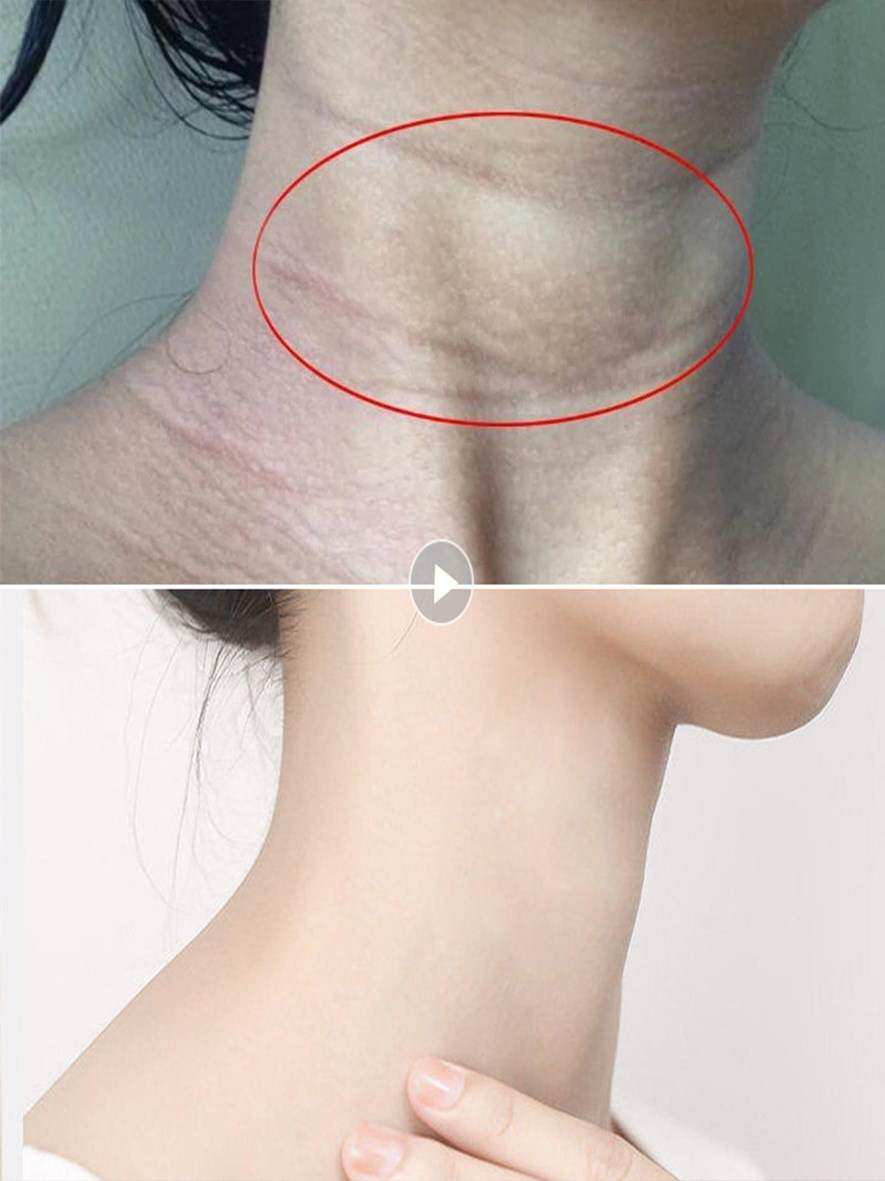 首页 下载app                          颈膜李佳琦面膜去颈纹嫩白