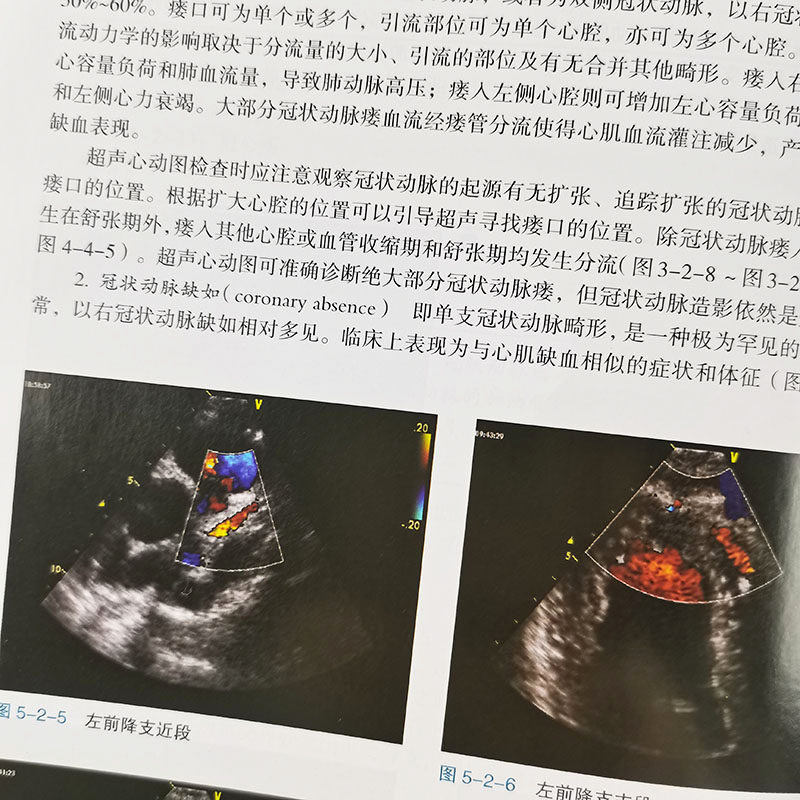 心脏超声入门科学好意杨好意第一笔记心超套装影像医学