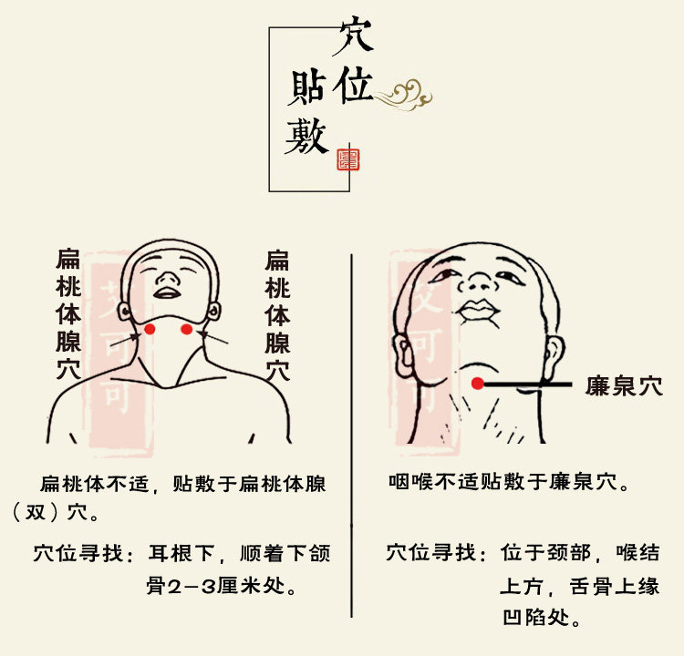 小儿咽扁贴嗓子不适宝宝咽扁贴喉咙疼扁桃体肥大咽喉扁桃体贴