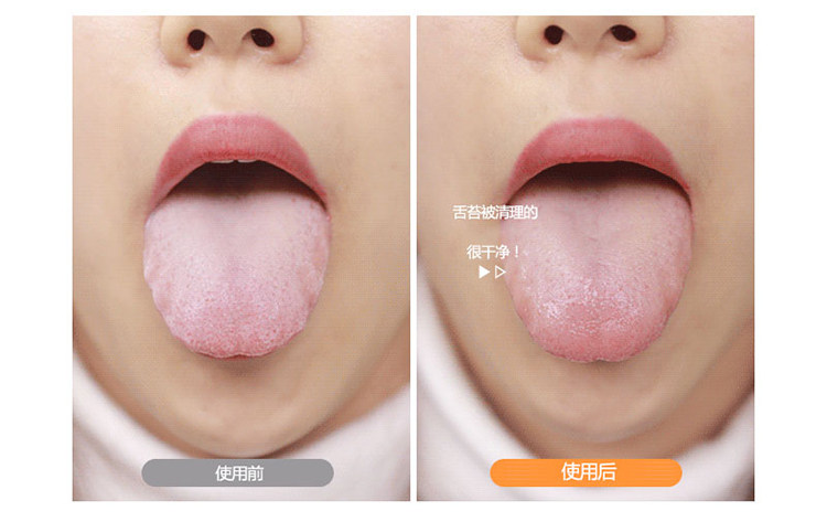 口腔清新没异味|commonhaus舌苔清洁器刮舌除口臭洗舌头神器清理
