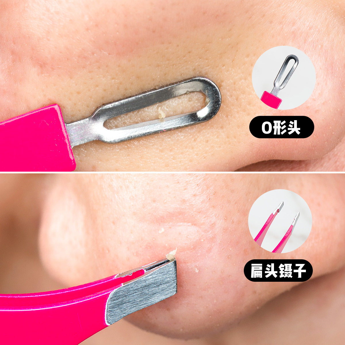 日本luckytrendy粉刺夹角鼻头清洁器细胞黑头工具化妆