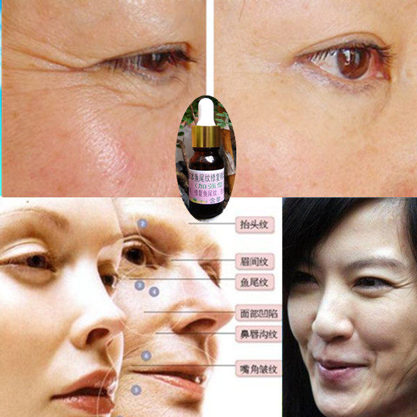 草本去眼鱼尾纹精华液除皱拉紧祛皱抗皱抗衰老精油液态精华