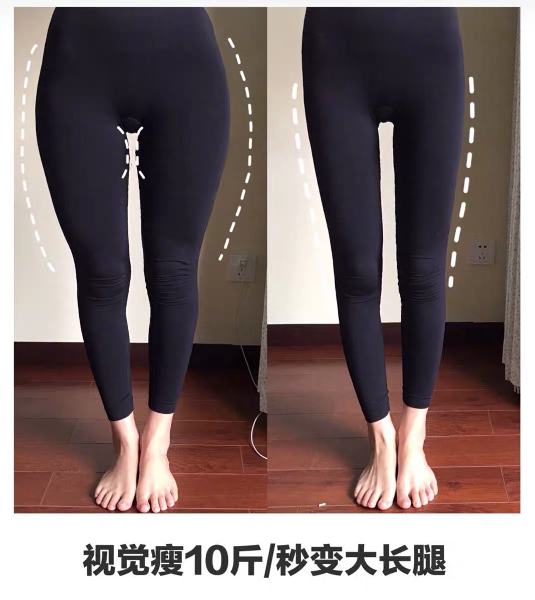 颜美家用修正前倾妈妈假胯美升产后神器复收骨盆修复仪