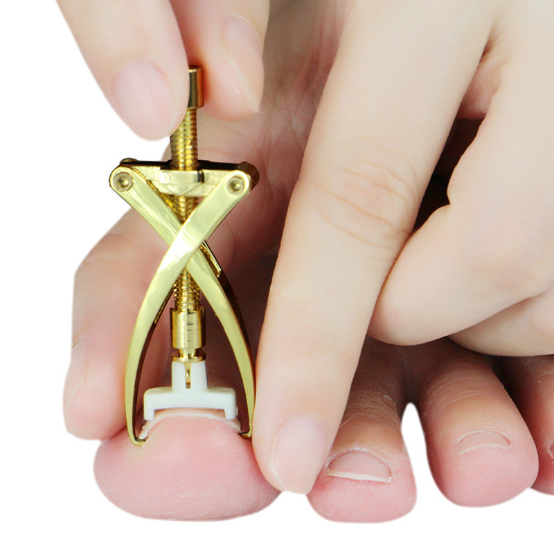 木阿阿日本设计脚指甲矫正器甲沟 剔翘甲器修脚用嵌甲矫正