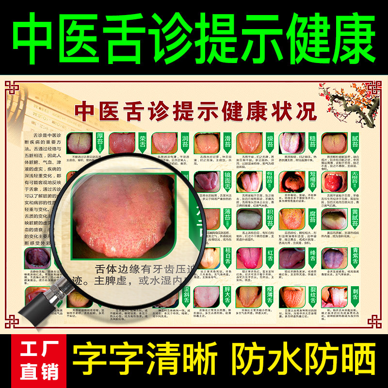 医院挂图舌诊健康状况对照表图解中医理疗口腔疾病写真