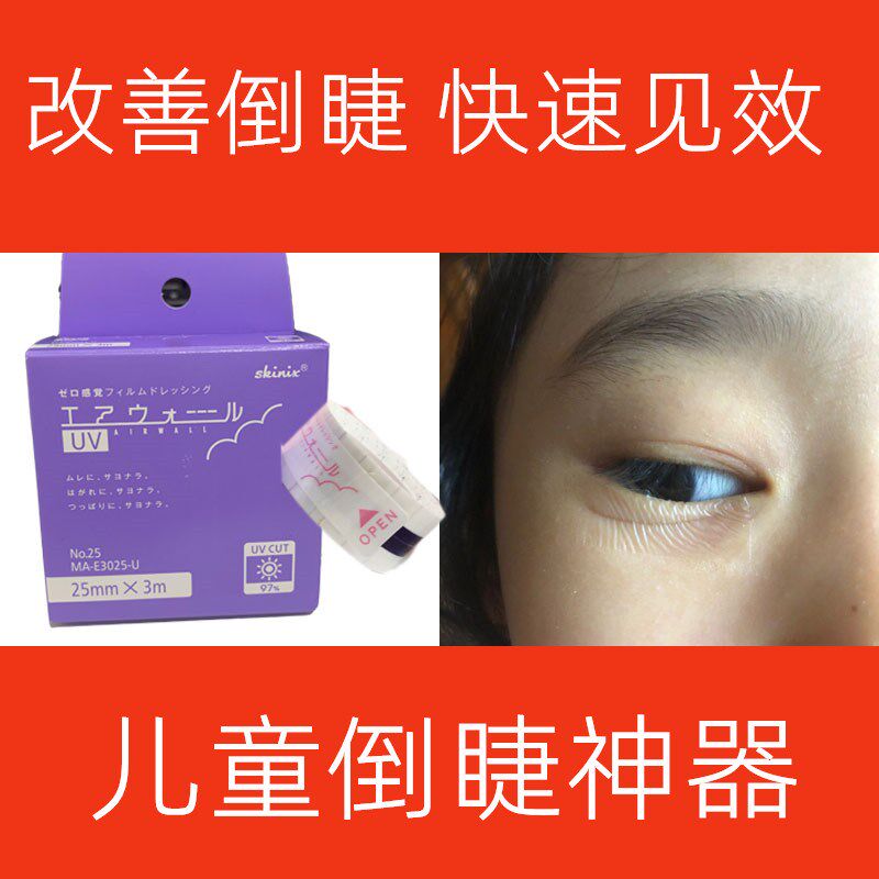 改善儿童娇正外翻眼内胶带睫毛倒睫眼睑老人胶带
