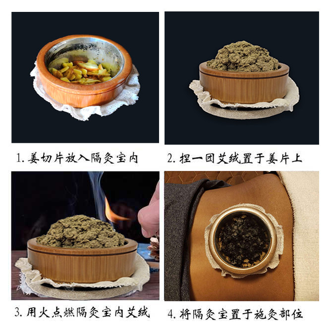 隔灸宝家用隔姜灸艾灸盒防烫艾绒艾盒督脉灸器具督脉灸脐灸督灸盒