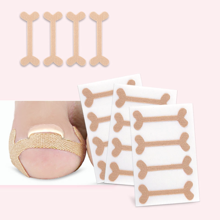 矫正甲沟嵌甲贴免胶水纠正贴卷修复专用指甲美甲