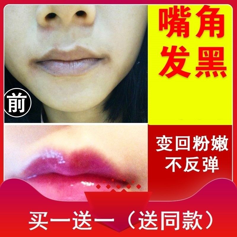 去除嘴角黑色素沉淀修复嘴唇嘴巴周围暗沉发黑私处保养