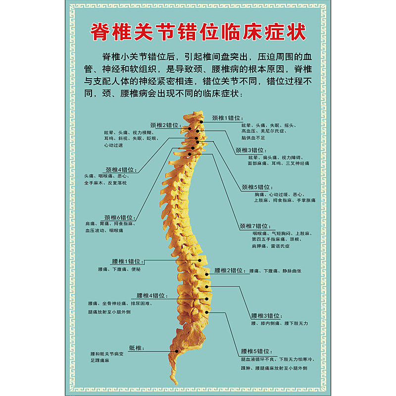 医院医学骨科挂图脊椎错位临床症状pvc高清写真写真