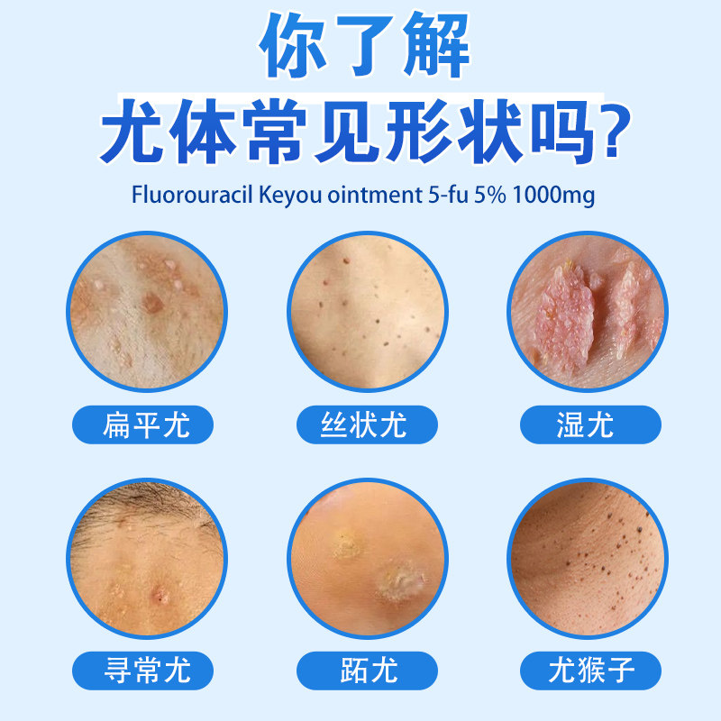 嘧啶一氟软膏正品旗舰店去疣药膏丝状疣肉粒佛尿皮肤消毒护理(消)