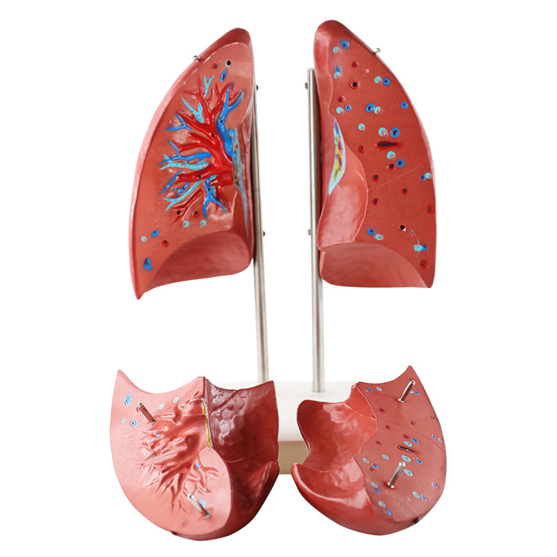 模型人体解剖肺部支气管呼吸系统结构构造教学医学其他模型玩具