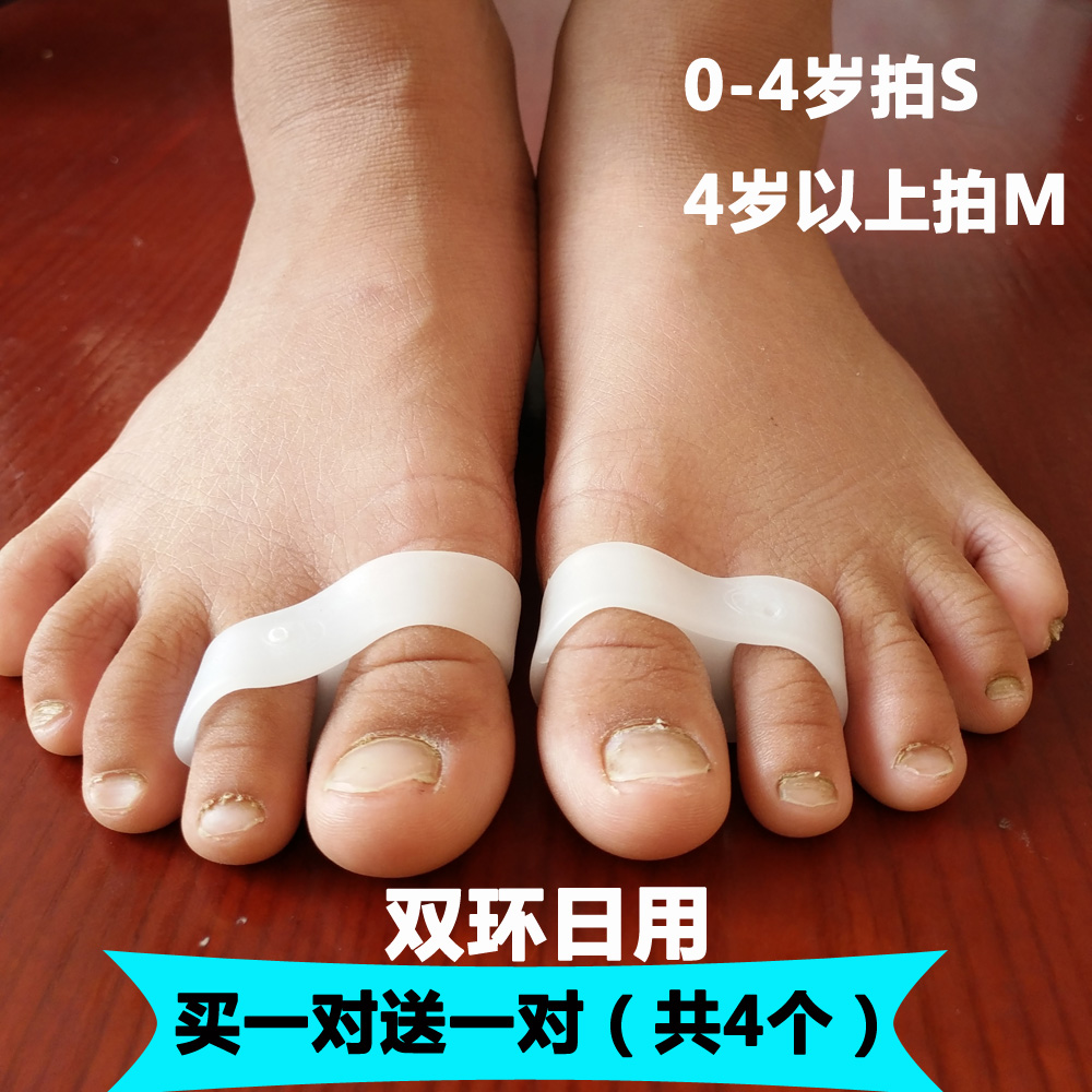 儿童小孩婴幼儿拇外翻矫正器脚趾挤压弯曲纠正分离器重叠脚趾拇指