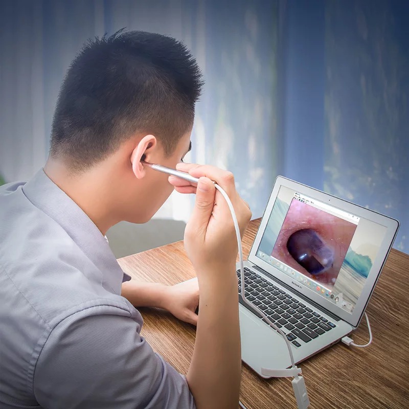 耳科赵医生可视挖耳勺高清手机外耳道内窥镜采耳神器可视掏耳朵勺