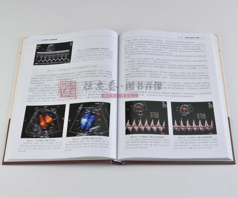 胎儿超声心动图学教程李胜利朱军李军9787030571755科学影像医学