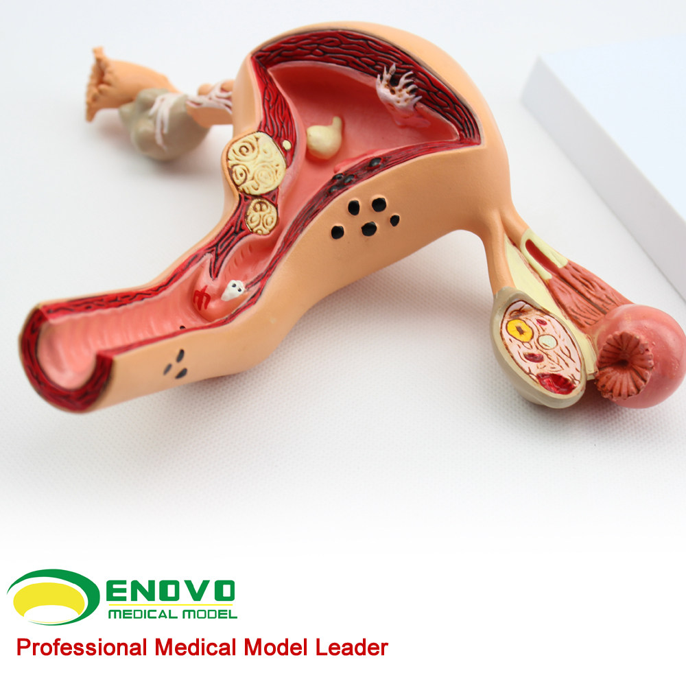 模型子宫沟通enovo医患教具生殖健康妇科演示讲解教学标本
