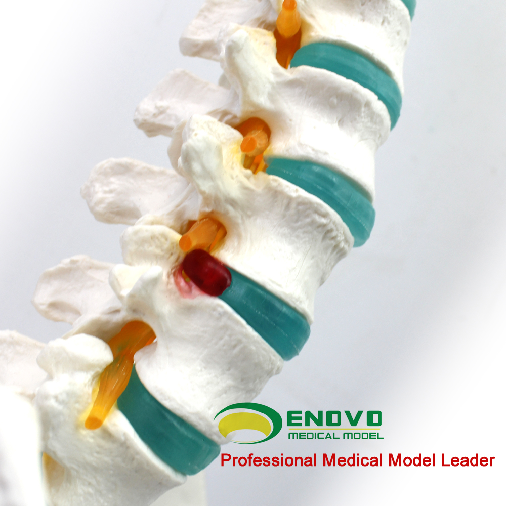 enovo医学1:1人体脊柱模型脊椎腰椎颈椎胸椎正骨骨科整骨模型中医脊柱