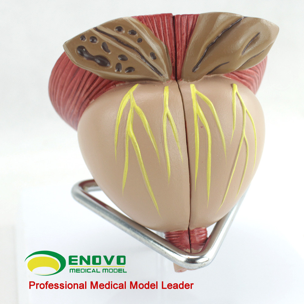 前列腺模型男科enovo颐诺医学解剖前列腺炎生殖健康区分教学仪器