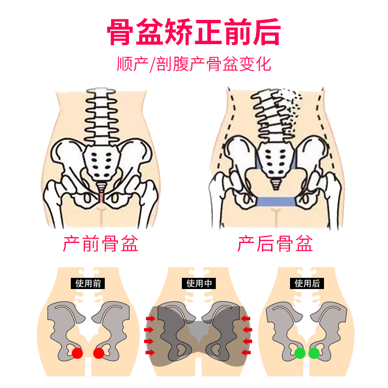 骨盆矫正带产后恢复盆骨修复仪家用胯骨收胯缩胯神器
