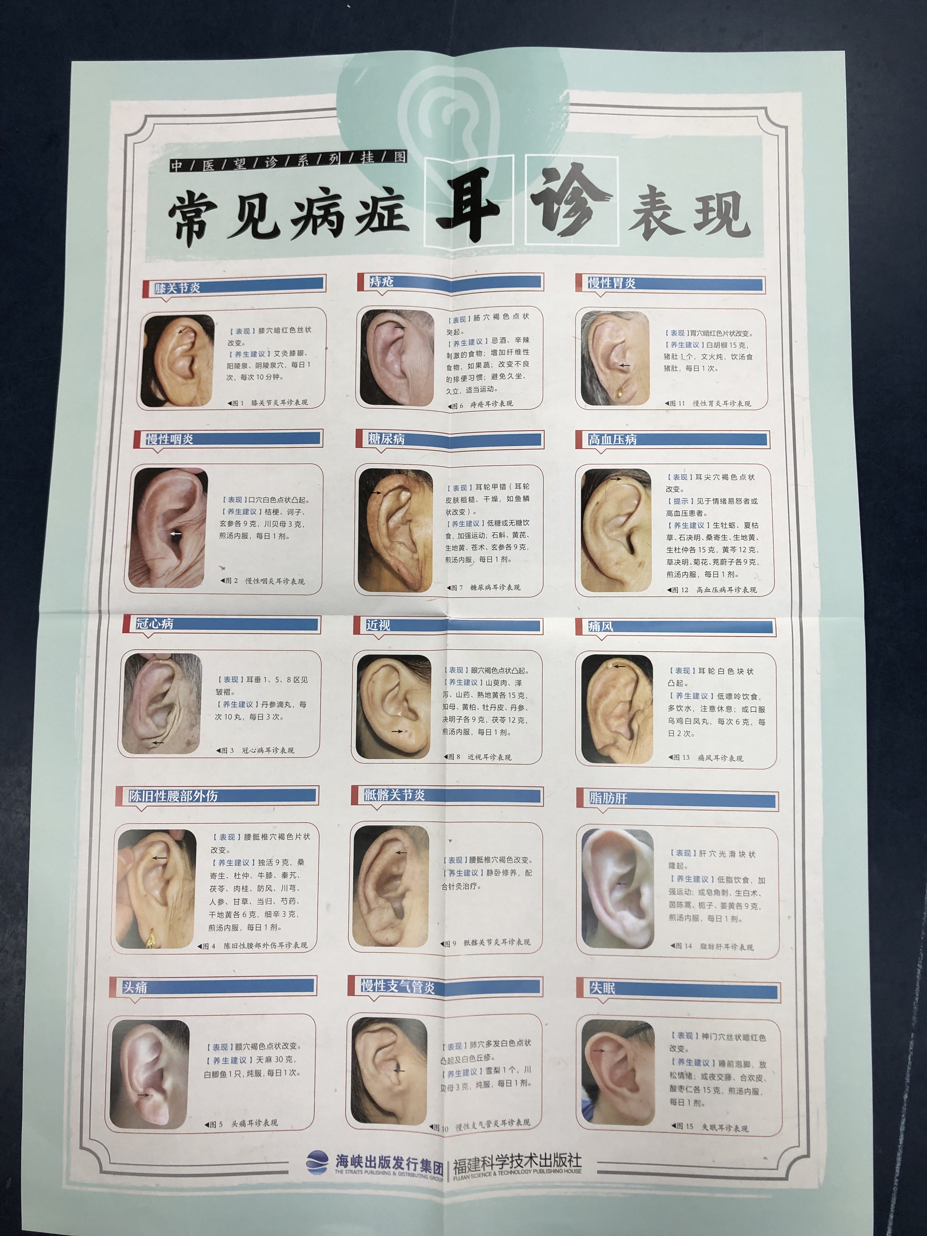 观耳诊病挂图 中医望诊系列挂图 2开高清挂图 图解耳诊书籍 中医常见