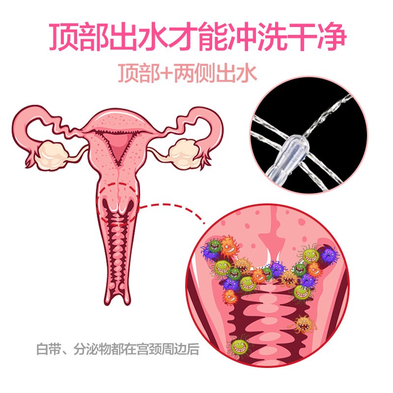 用洗阴器洗出豆腐渣图片