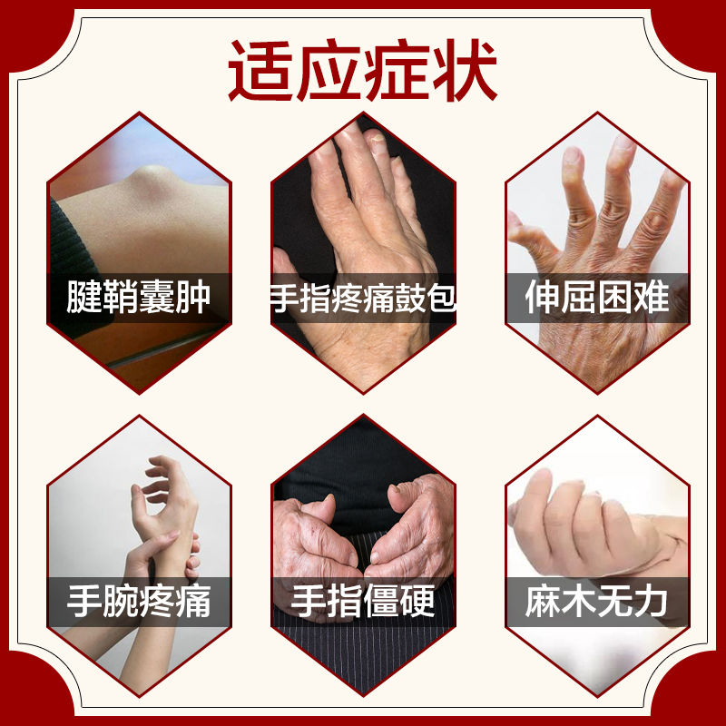 腱鞘涂抹膏大拇指腱鞘炎腱鞘囊肿舒筋贴手腕鼓包关节肿大突出膏药