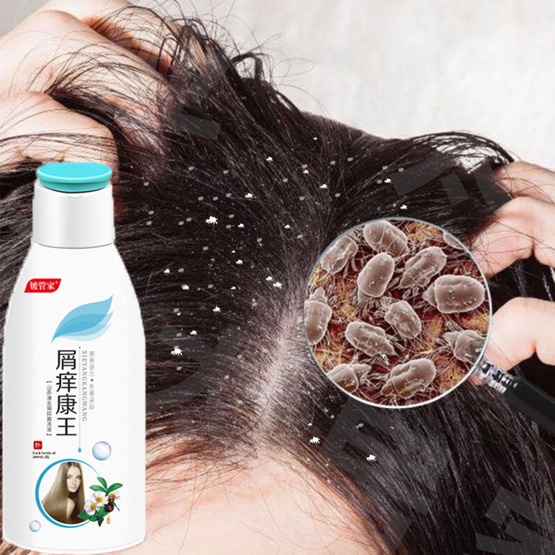 康王去屑止痒防脱洗发水脂性头皮控油清爽螨虫洗发水