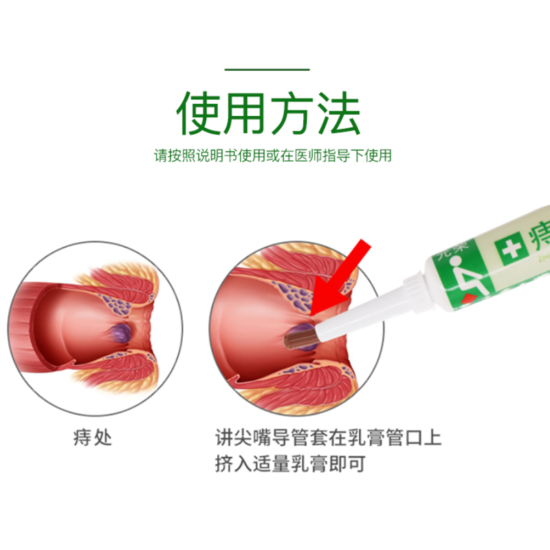 痔疮栓的使用方法图解图片