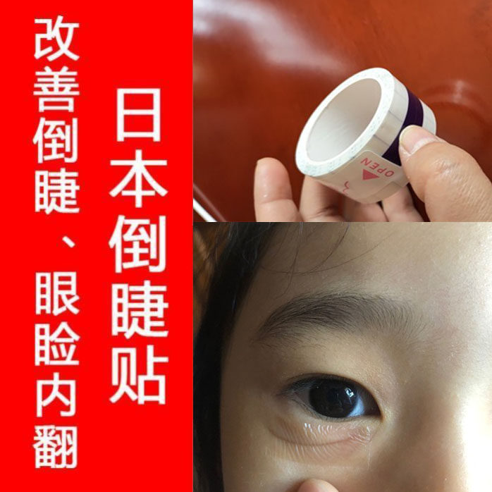 睫毛胶布改善矫正胶带眼贴内倒过敏日本眼睑胶带
