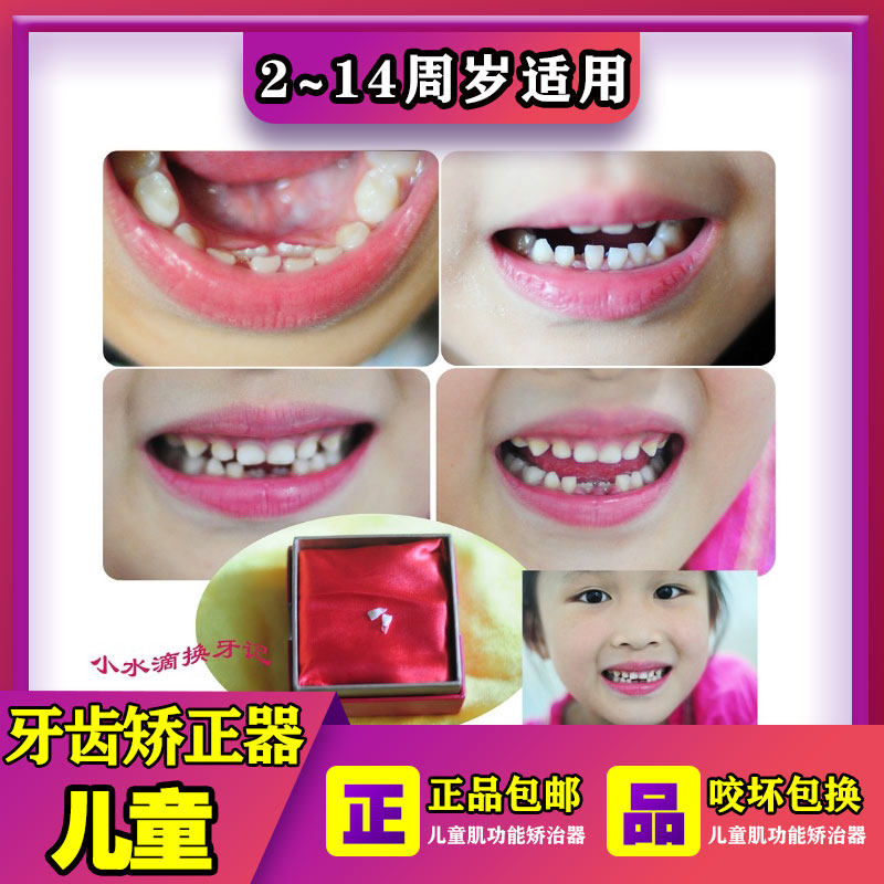 儿童牙齿牙套矫正器整神器夜间隐形透明纠正齿科器械