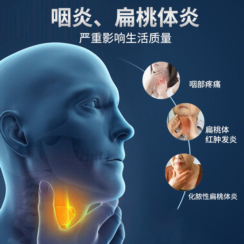 祖医堂咽扁康冷敷敷贴慢性咽喉炎扁桃体发炎李时珍口咽类修复品