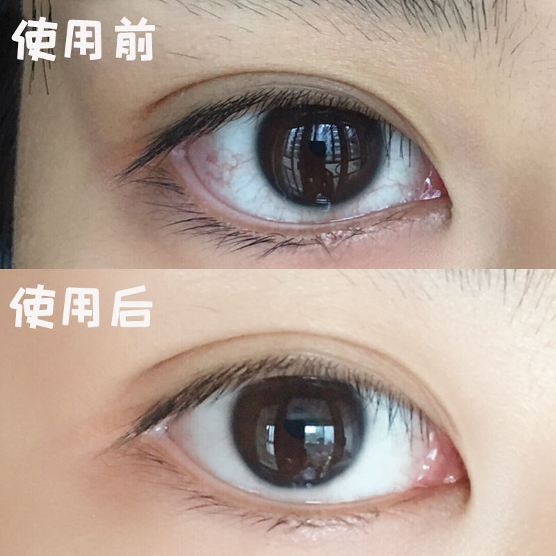 眼睛春日日井山茶花干涩洗眼液护理清洁缓解疲劳眼部护理套装