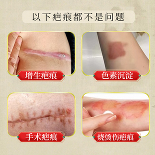 丹参疤痕保健膏香港大药房旗舰店皮肤损伤蚊叮虫咬术后疤痕通用9