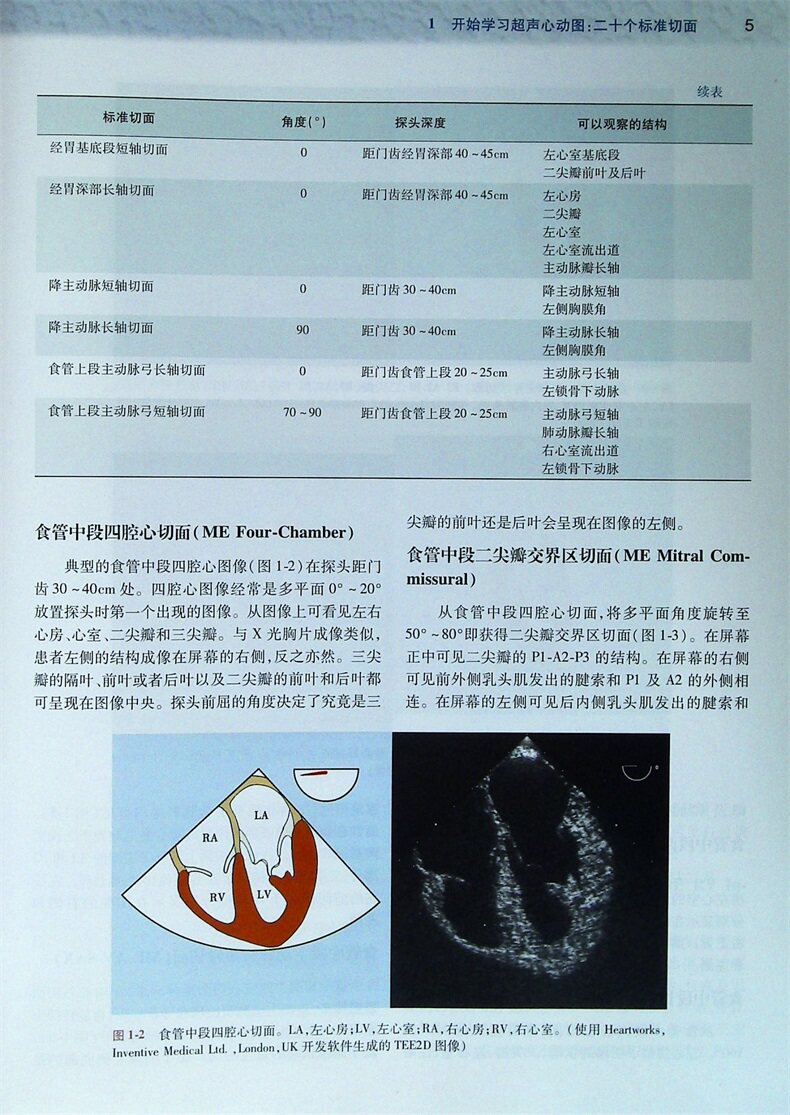正版围术期经食管超声心动图学 于晖王晟宋海波彭勇刚主译 二维经食道