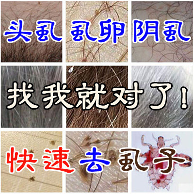 去头上长虱子药头虱儿童一扫光清虱露跳蚤小女孩头发百部酊洗发水