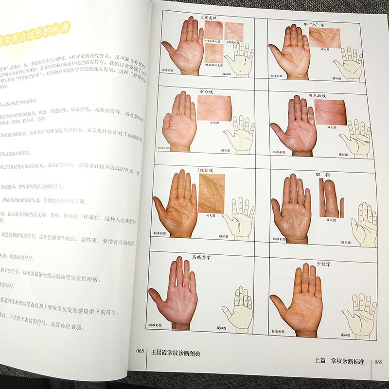图解王晨正版穴位护肝大全宝典手诊看懂都能中医养生