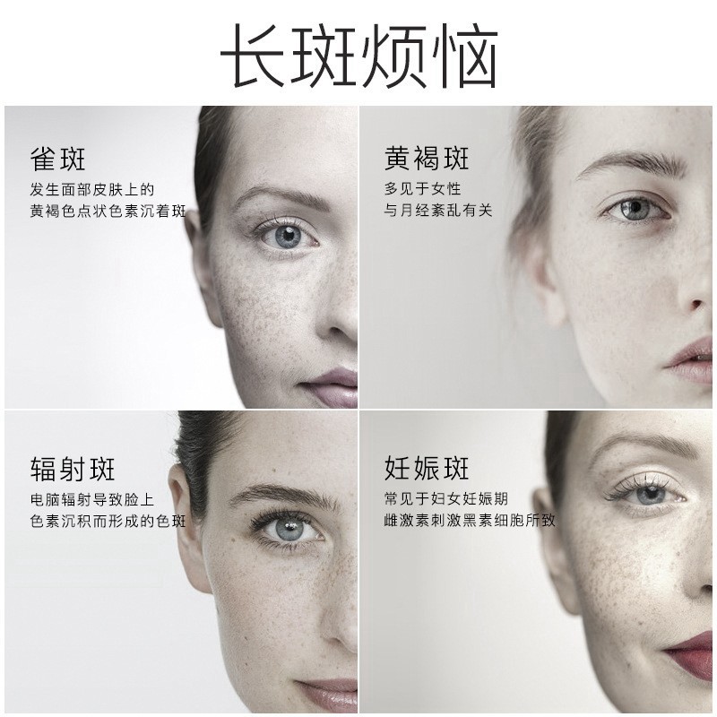 熊果苷乳膏美白祛斑淡化色斑雀斑去黄提亮肤色乳液