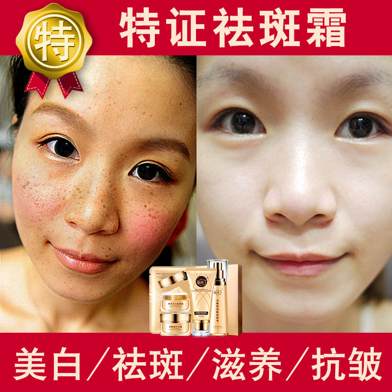 效果最好的祛斑方法——猪猪猪匠心品质缔造传奇