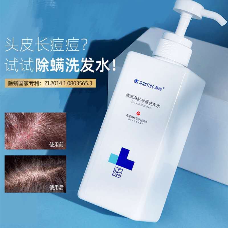 洗发水满婷海盐去屑止痒控油头螨洗发露洗发水