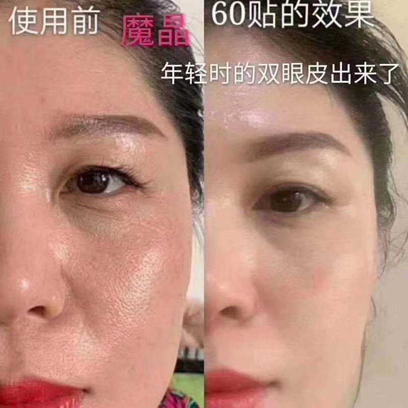 魔晶面膜微整正品蛋白生物抗皱拉紧透明模具贴片面膜