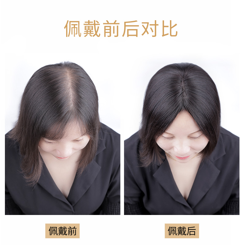 局部假发女头顶补发块真发补发片假刘海假发盖无痕遮白发假发片