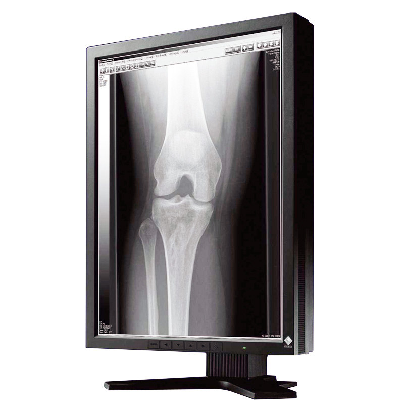 crdr医用显示器医疗eizo艺卓灰阶黑白gx530显示器
