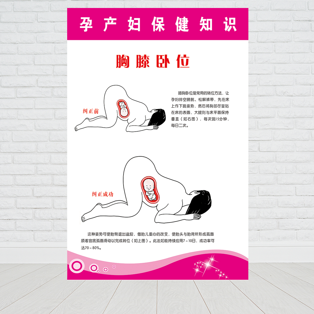 医院卫生制度文化妇产科胸膝卧位挂图走廊墙贴写真