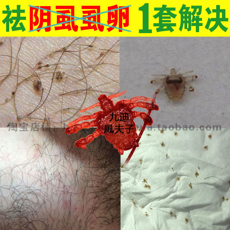 阴虱虱子大人用的男女女士私处杀白部酊药喷剂杀虫剂卫生农药