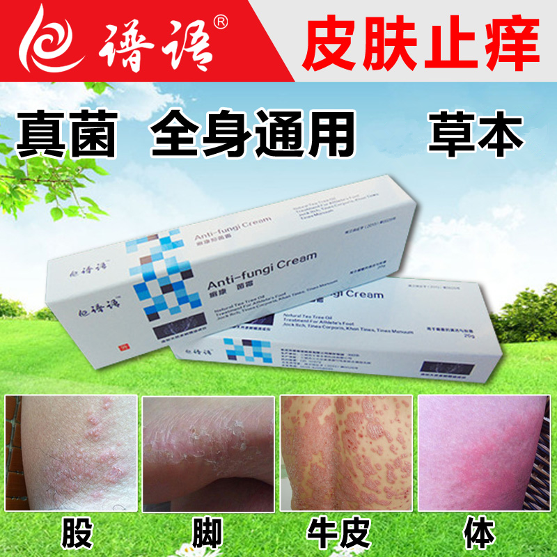 治皮肤手足外用药膏真菌特效成人癣康霜脚止痒软膏瘙痒廯藓鲜牛皮