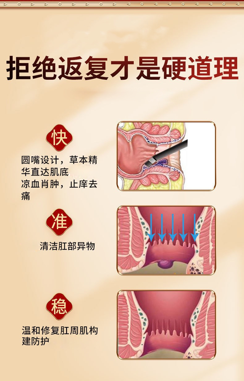 华佗痔疮膏苗方内外混合肉球痔肛部产后福临十八空气净化剂
