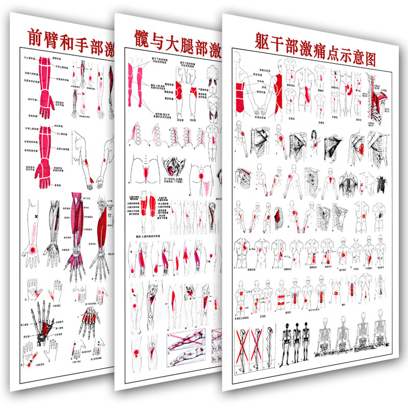 放心好店医院人体肩臂部激痛点示意图挂图