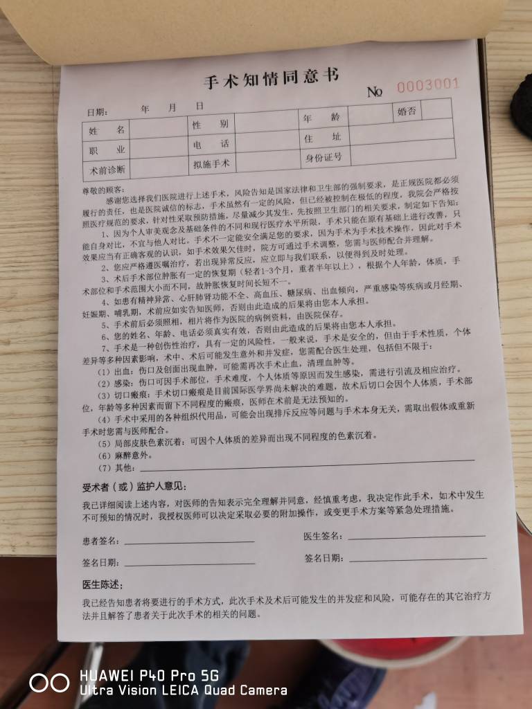 手术通知单真实图片