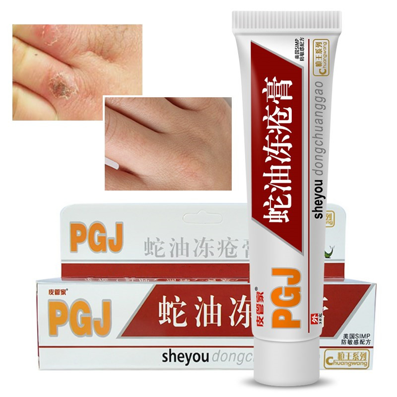 红花蛇油冻疮膏特效速效冻必治正品止痒防裂手护手霜