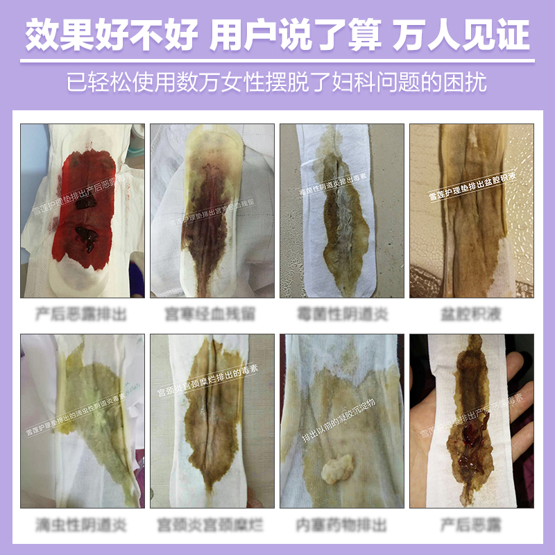 正品净牌护理垫私处排毒护垫妇科私密调理止痒天山雪莲生态保养贴